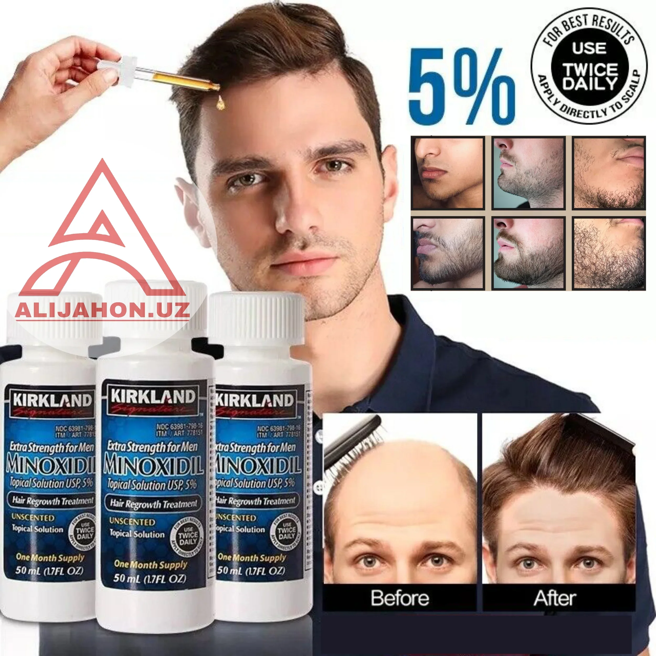 MINOXIDIL 5%