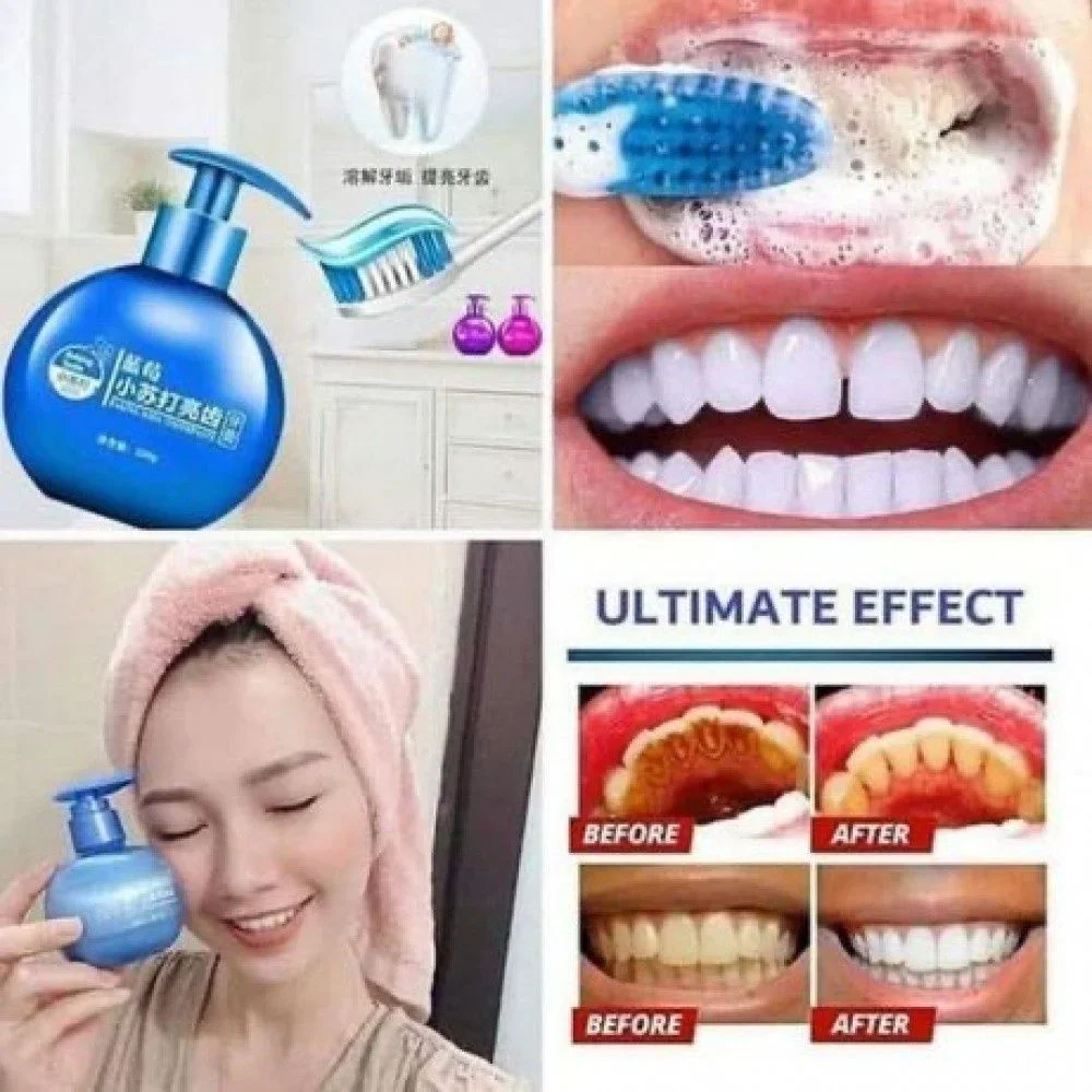 TISH GEL