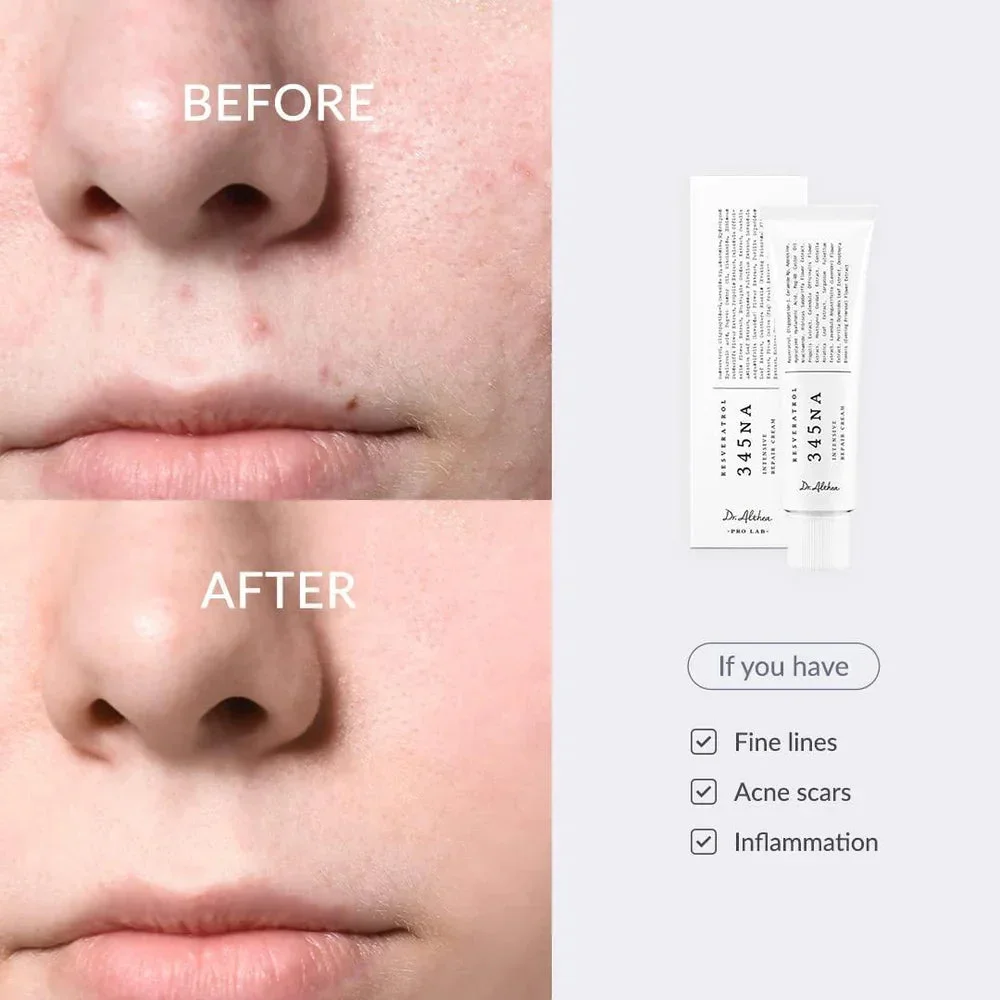 Relief Cream 345